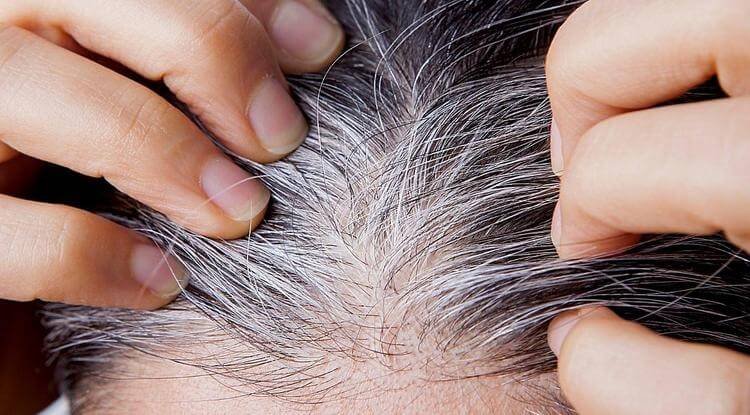 White Hair: Is it Truly Stress-Related?